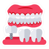 Dentures and Implants